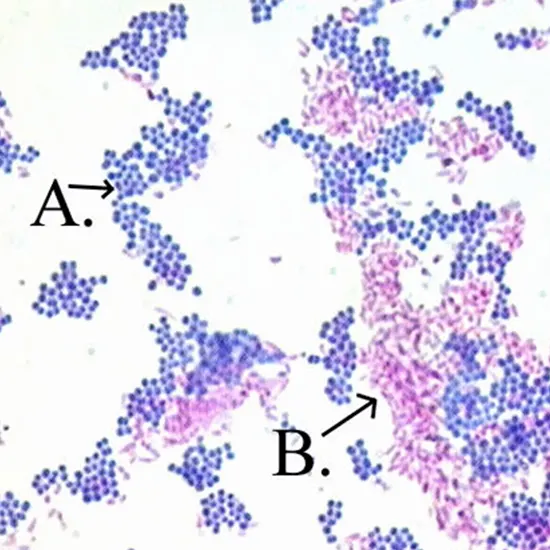 Acid Fast Bacilli (AFB) Stain (3 Samples)